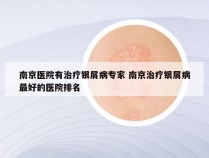 南京医院有治疗银屑病专家 南京治疗银屑病最好的医院排名