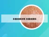 长春皮肤诊所 长春皮肤科