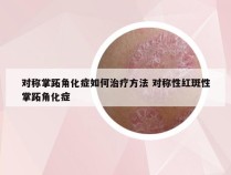 对称掌跖角化症如何治疗方法 对称性红斑性掌跖角化症