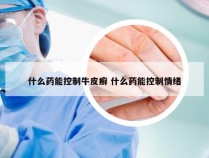 什么药能控制牛皮癣 什么药能控制情绪