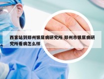 西客站到郑州银屑病研究所 郑州市银屑病研究所看病怎么样