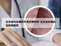 北京金科白癜风外用药哪种好 北京金科银科皮肤病医院