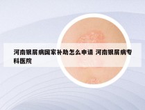 河南银屑病国家补助怎么申请 河南银屑病专科医院