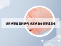 银屑病要注意润肤吗 银屑病患者需要注意啥