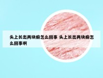 头上长出两块癣怎么回事 头上长出两块癣怎么回事啊