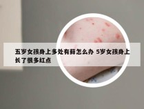 五岁女孩身上多处有藓怎么办 5岁女孩身上长了很多红点