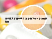 孩子腋窝下面一块白 孩子腋下有一小块皮肤发白