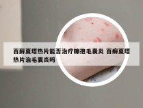 百藓夏塔热片能否治疗糠孢毛囊炎 百癣夏塔热片治毛囊炎吗