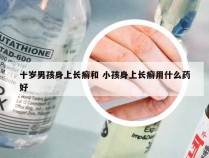 十岁男孩身上长癣和 小孩身上长癣用什么药好