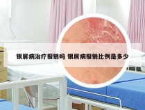 银屑病治疗报销吗 银屑病报销比例是多少