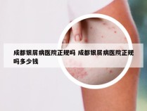 成都银屑病医院正规吗 成都银屑病医院正规吗多少钱