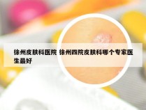 徐州皮肤科医院 徐州四院皮肤科哪个专家医生最好