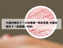 大腿内侧长了一小块像癣一样的东西 大腿内侧长了一些像癣一样的