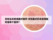 安阳治皮肤病最好医院 安阳最好的皮肤病医院是哪个医院?