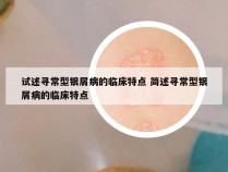 试述寻常型银屑病的临床特点 简述寻常型银屑病的临床特点