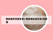 银屑病天然维生素e 银屑病吃维生素e软胶囊