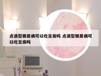 点滴型银屑病可以吃豆腐吗 点滴型银屑病可以吃豆腐吗