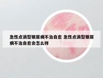 急性点滴型银屑病不治自愈 急性点滴型银屑病不治自愈会怎么样