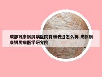 成都银康银屑病医院有谁去过怎么样 成都银康银屑病医学研究院