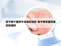 南宁哪个医院牛皮癣比较好 南宁哪家医院看皮肤病好