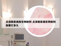 点滴银屑病用生物制剂 点滴银屑病生物制剂需要打多久