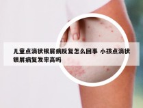 儿童点滴状银屑病反复怎么回事 小孩点滴状银屑病复发率高吗