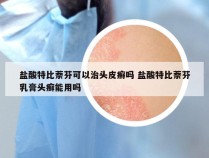 盐酸特比萘芬可以治头皮癣吗 盐酸特比萘芬乳膏头癣能用吗