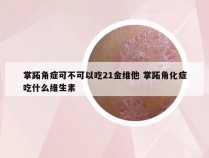 掌跖角症可不可以吃21金维他 掌跖角化症吃什么维生素