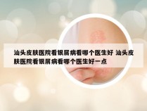 汕头皮肤医院看银屑病看哪个医生好 汕头皮肤医院看银屑病看哪个医生好一点