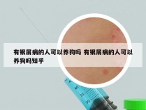 有银屑病的人可以养狗吗 有银屑病的人可以养狗吗知乎