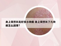 身上突然长出好多小块癣 身上突然长了几块癣怎么回事?