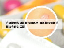 消银颗粒和银屑颗粒的区别 消银颗粒和银消颗粒有什么区别