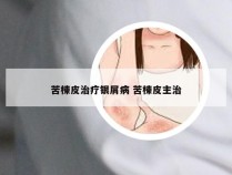 苦楝皮治疗银屑病 苦楝皮主治