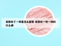 皮肤白了一块是怎么回事 皮肤白一块一块的什么病