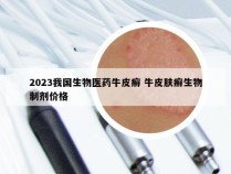 2023我国生物医药牛皮癣 牛皮肤癣生物制剂价格