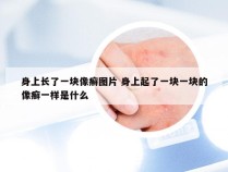 身上长了一块像癣图片 身上起了一块一块的像癣一样是什么