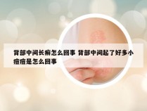 背部中间长癣怎么回事 背部中间起了好多小痘痘是怎么回事