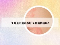 头藓是不是治不好 头藓能根治吗?