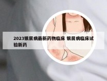 2023银屑病最新药物临床 银屑病临床试验新药