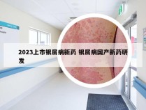 2023上市银屑病新药 银屑病国产新药研发