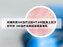 白癜风用308治疗过后4个小时能身上出汗好不好 308治疗白斑后容易复发吗