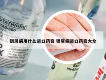 银屑病用什么进口药膏 银屑病进口药膏大全