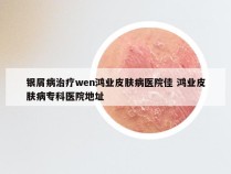 银屑病治疗wen鸿业皮肤病医院佳 鸿业皮肤病专科医院地址