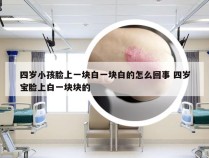 四岁小孩脸上一块白一块白的怎么回事 四岁宝脸上白一块块的