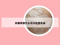 白癜风做什么可以检查出来