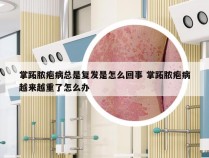 掌跖脓疱病总是复发是怎么回事 掌跖脓疱病越来越重了怎么办