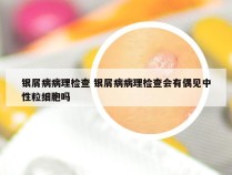 银屑病病理检查 银屑病病理检查会有偶见中性粒细胞吗