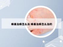 蜂巢治癣怎么治 蜂巢治癣怎么治的