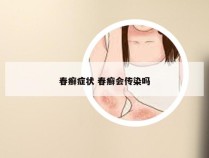 春癣症状 春癣会传染吗