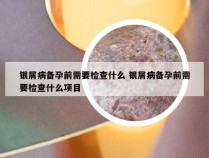 银屑病备孕前需要检查什么 银屑病备孕前需要检查什么项目